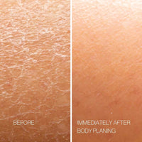 Body Plane Exfoliation Tool Set